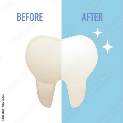 Tooth whitening modern illustration. Teeth Whitening. Before and after veneers installation isolated on white background