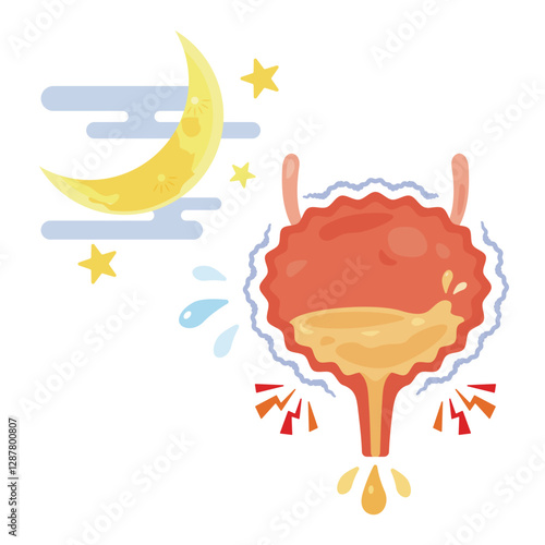 夜間頻尿を起こす膀胱のイラスト