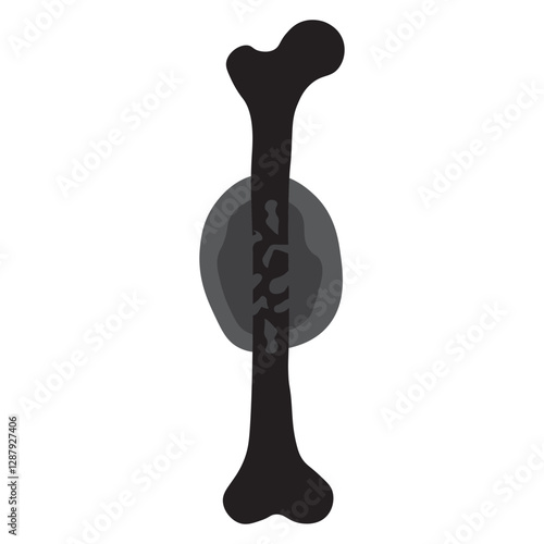 Ewing sarcoma glyph icon