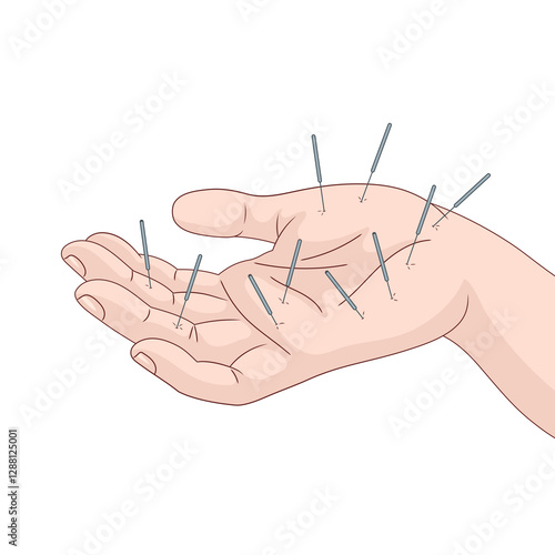 Obraz na plátně hand with multiple acupuncture needles inserted, representing traditional Chinese medicine for pain relief and therapy diagram hand drawn raster illustration