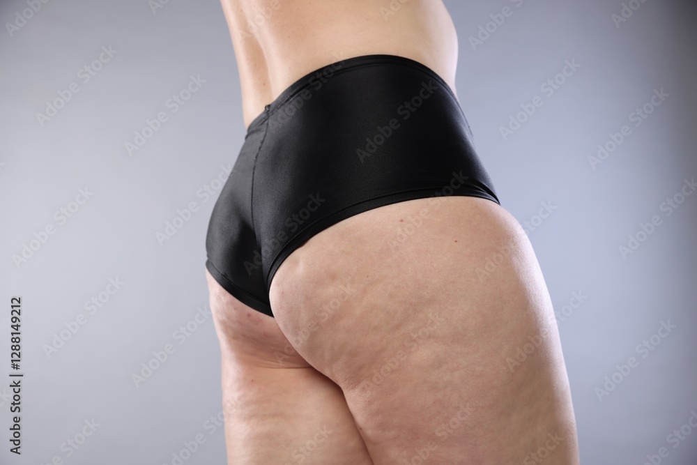 Fototapeta premium Woman with cellulite on light grey background, closeup