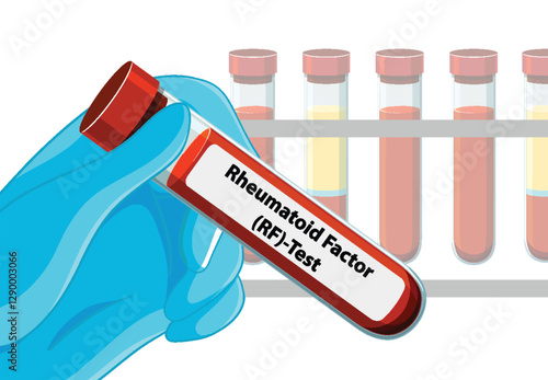 Rheumatoid Factor Blood Test Illustration