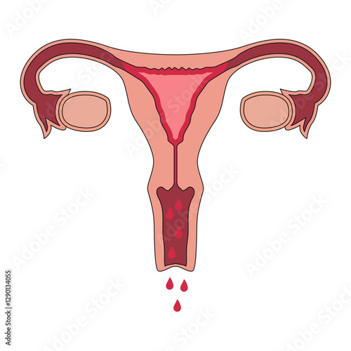 menstruation