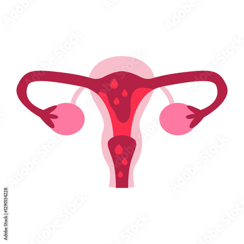 menstruation