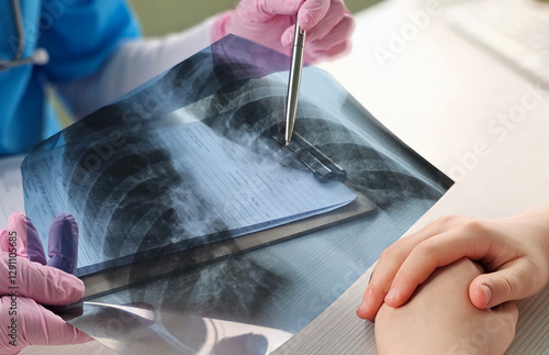 Lung radiography concept. radiology doctor examining at chest x ray film of patient at hospital concept