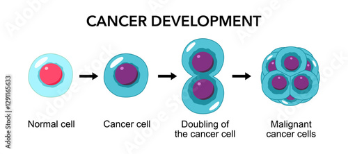 Cancer development. Normal cells are transformed into cancer. Carcinogenesis from Genetic mutations in healthy cell to Malignant cancer cells. Mutagenesis, Oncogenesis, tumorigenesis. Tumor formation
