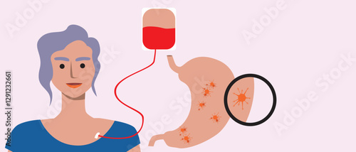 Cancer patients silhouettes and cancer ribbon, silhouette vector stock illustration with unidentifiable people together as a template with space for text or copy space