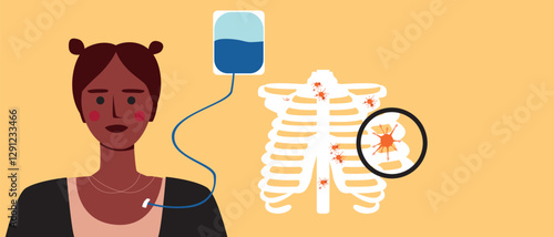 Cancer patients silhouettes and cancer ribbon, silhouette vector stock illustration with unidentifiable people together as a template with space for text or copy space