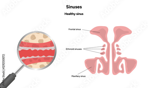 Sinuses anatomy healthy sinus. Nose nasal anatomy. Healthy Nasal Cavity 