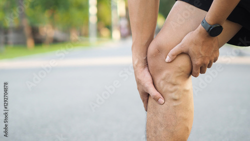 Tableau sur toile Varicose veins on the legs of men