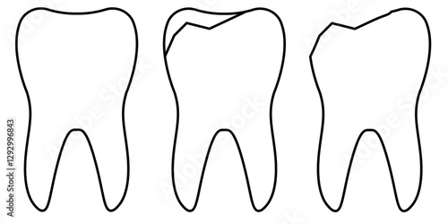 Illustration of Healthy and Damaged Teeth Outlines Showing Dental Concepts