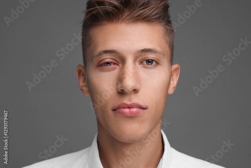 Bild auf Leinwand Conjunctivitis. Young man with red eye on grey background