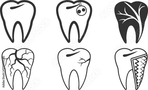 Various tooth silhouettes with cracks, decay, and damage in vector design, ideal for dental, healthcare, and hygiene-themed artwork