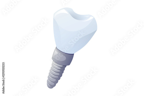 Dental cartoon implant with titanium screw and white ceramic crown, vector isolated illustration on white background. Realistic tooth restoration concept for prosthetics, oral surgery, and dentistry.