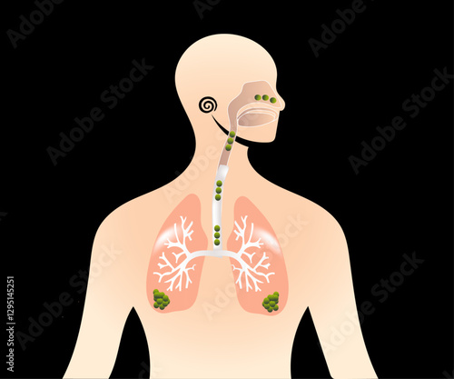 Aflatoxins,  human health, carcinogen
