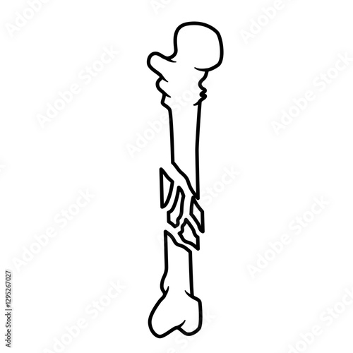 bone fracture