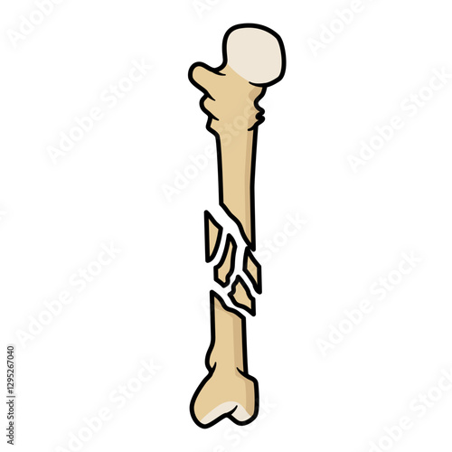 bone fracture