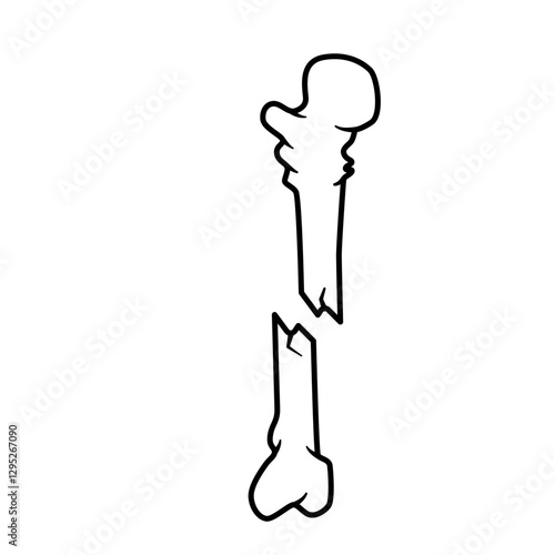 bone fracture