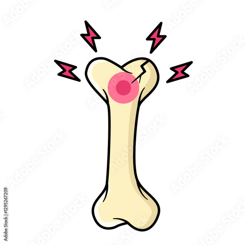 bone fracture