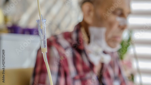 An elderly man with cancer, being fed with medical nutritional formula through a tube in his nose, sits sadly on the balcony of his home