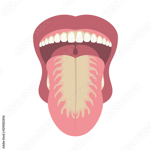 Oral Thrush Illustration