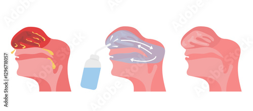 Irrigation of nasal passages. Relief and treatment from allergies, reducing inflammation, cleaning the nasal passages, hydration, improvement of nasal function