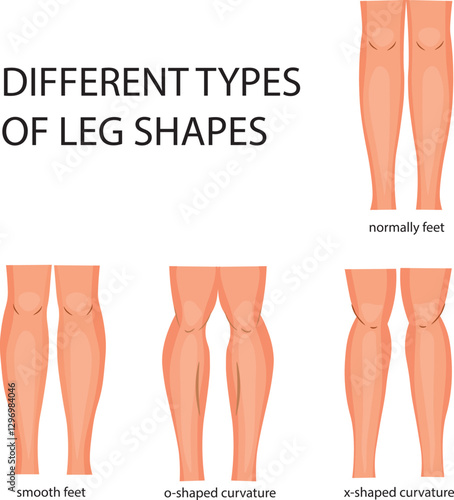 Different types of leg shapes