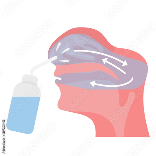 Irrigation of nasal passages. Relief and treatment from allergies, reducing inflammation, cleaning the nasal passages, hydration, improvement of nasal function