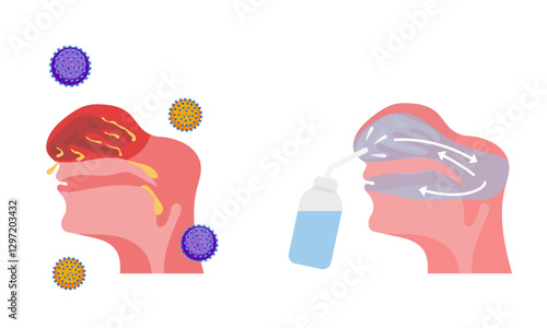 Irrigation of nasal passages. Relief and treatment from allergies, reducing inflammation, cleaning the nasal passages, hydration, improvement of nasal function