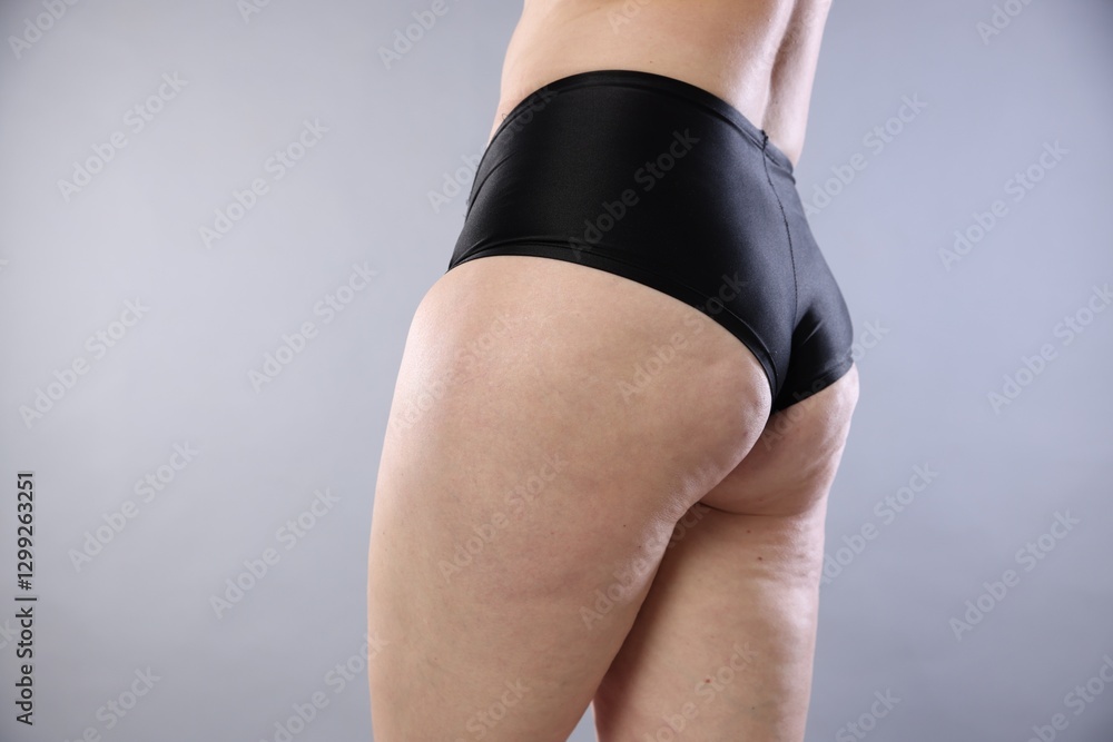Fototapeta premium Woman with cellulite on light grey background, closeup