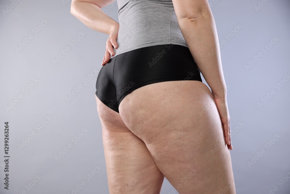 Fototapeta premium Woman with cellulite on light grey background, closeup