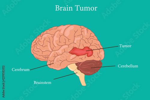 Brain problem. Malignant cells develop in the human brain. Human brain structure anatomy on green background. eps 10