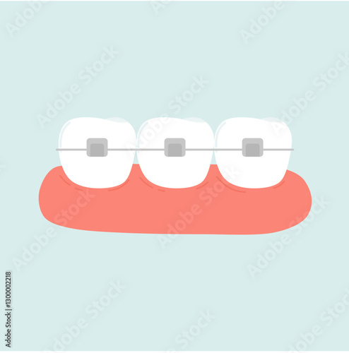Orthodontic Braces Tooth Treatment. Dental Care Illustration