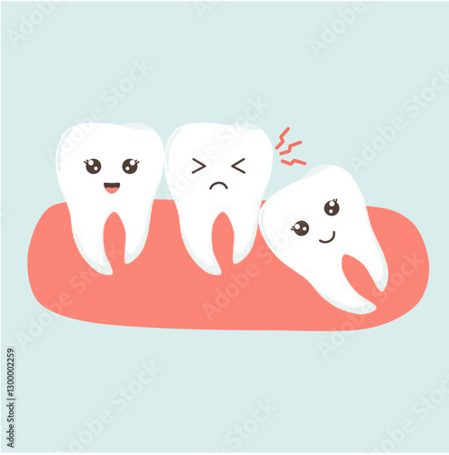 Impaction Teeth Illustration. Wisdom Teeth Eruption