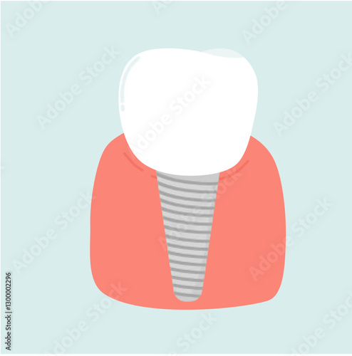 Implant Tooth Dental Care Illustration