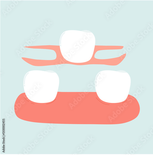 Dentures for Dental Problem Solution Illustration