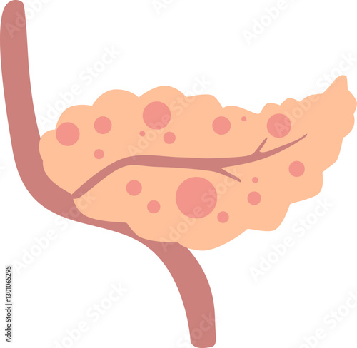 A diagram of the pancreas