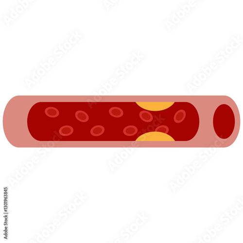 cholesterol palque colored icon