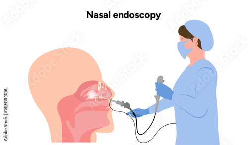 Nasal endoscopy procedure nasal and sinus passages. Thin, flexible tube with camera and light. Ear, nose, and throat doctor otolaryngologist. Medical diagram
