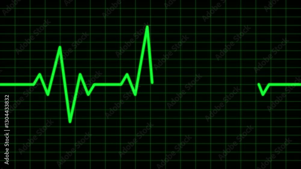 Green Color Electrocardiogram animation on a grid background. 4K Video Green Color Electrocardiogram animation on a grid background. 4K Video