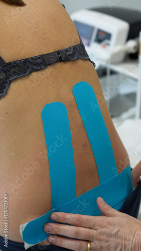 Close-up of a physiotherapist using therapeutic patches on a woman’s back for pain treatment