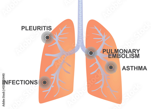 Lungs pain disorders. vector illustration