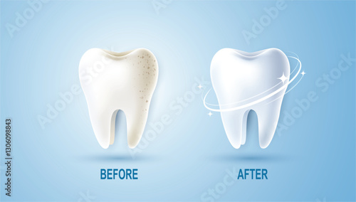 Set of dental cleaning and whitening teeth concept. comparison of clean and dirty tooth. dental health and oral hygiene poster for dentistry. examination teeth, whitening and repair. vector design.