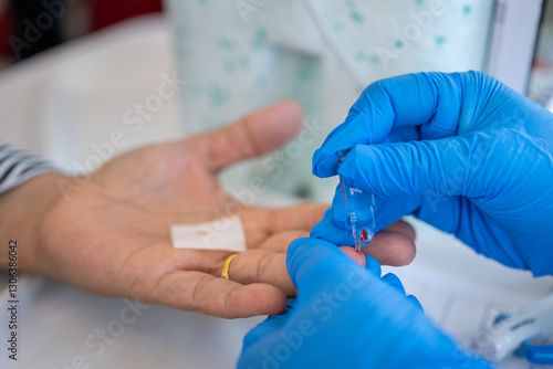 Fotografia A healthcare worker wearing blue gloves collects a blood sample from a patient's fingertip using a capillary tube