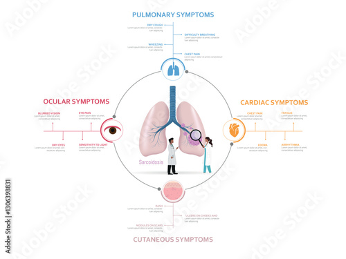 Doctors studying sarcoidosis, examining pulmonary, ocular, cardiac, and cutaneous symptoms