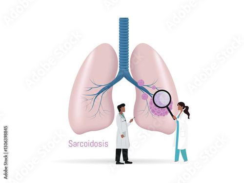 Doctors studying sarcoidosis granuloma in human lungs illustration