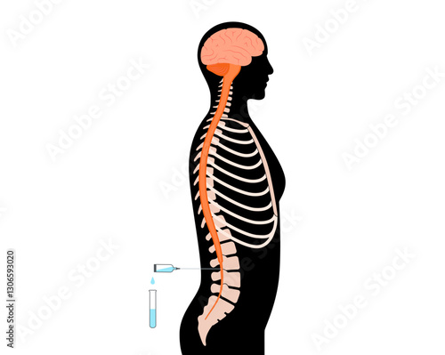 Lumbar puncture spinal tap