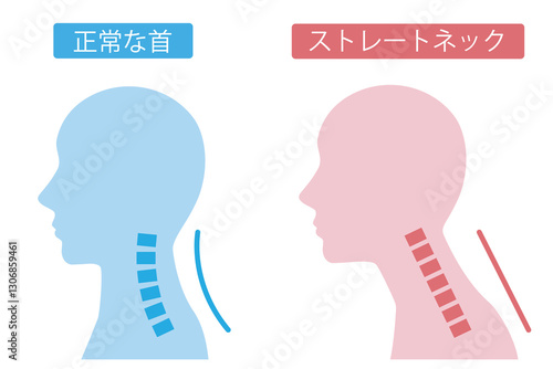 四角ストレートネック中性青桃