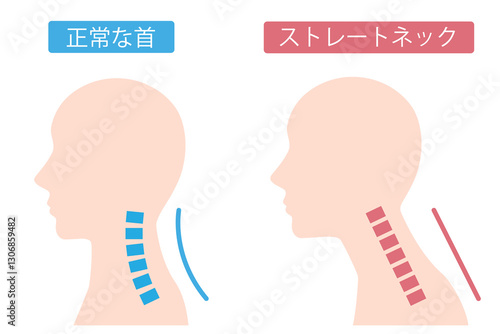 四角ストレートネック中性肌色