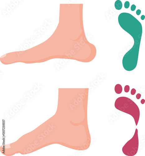 high arch foot